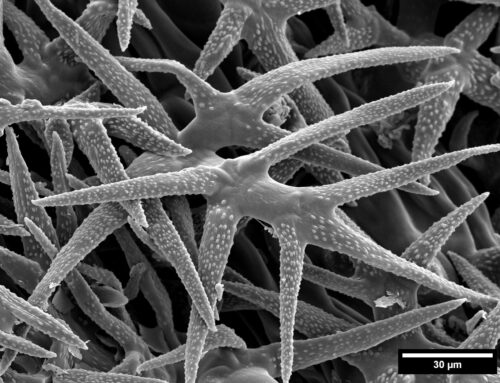 Trichomes de la feuille de lavande (Lavandula sp.)